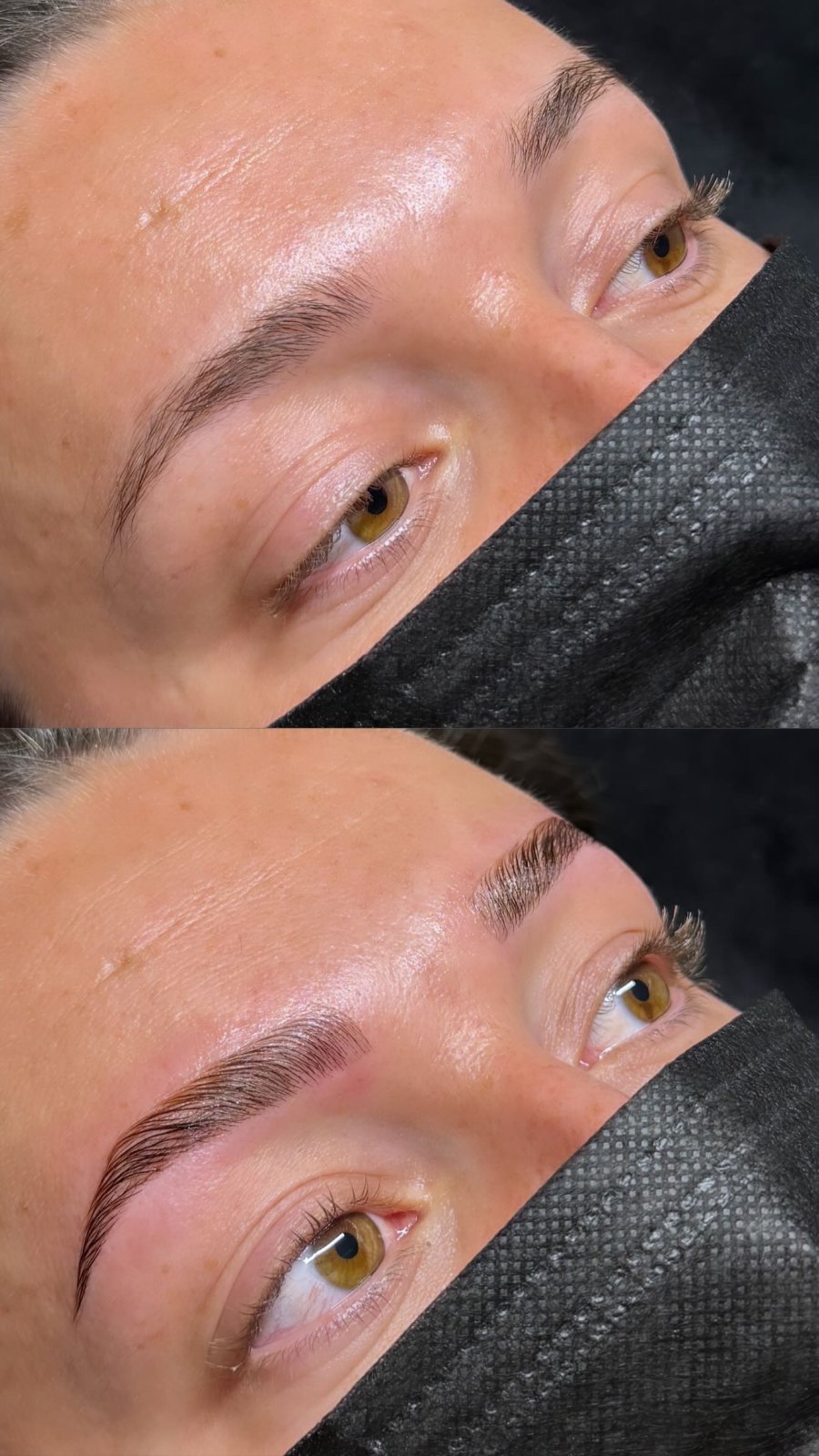 Browlift Signature