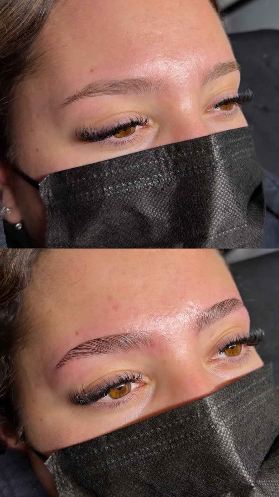 Browlift Naturel