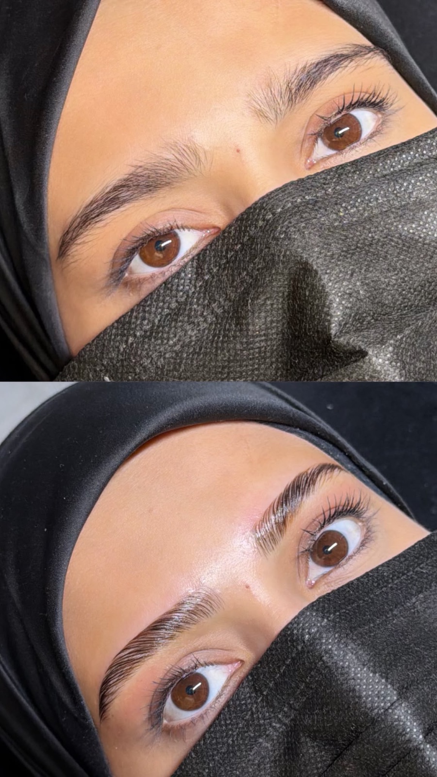Browlift Naturel, photo 3